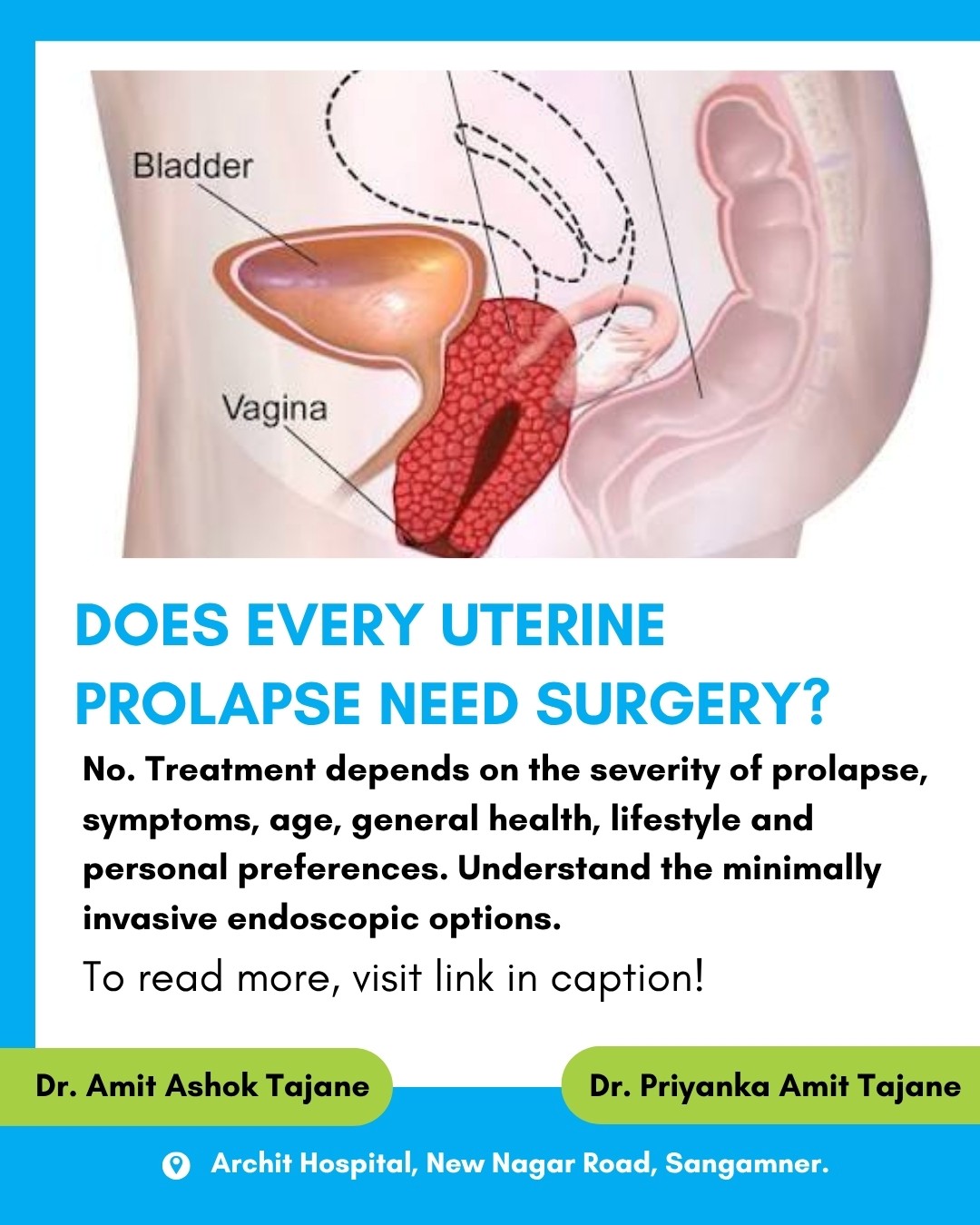 Uterine Prolapse: Laparoscopic Treatment in Sangamner