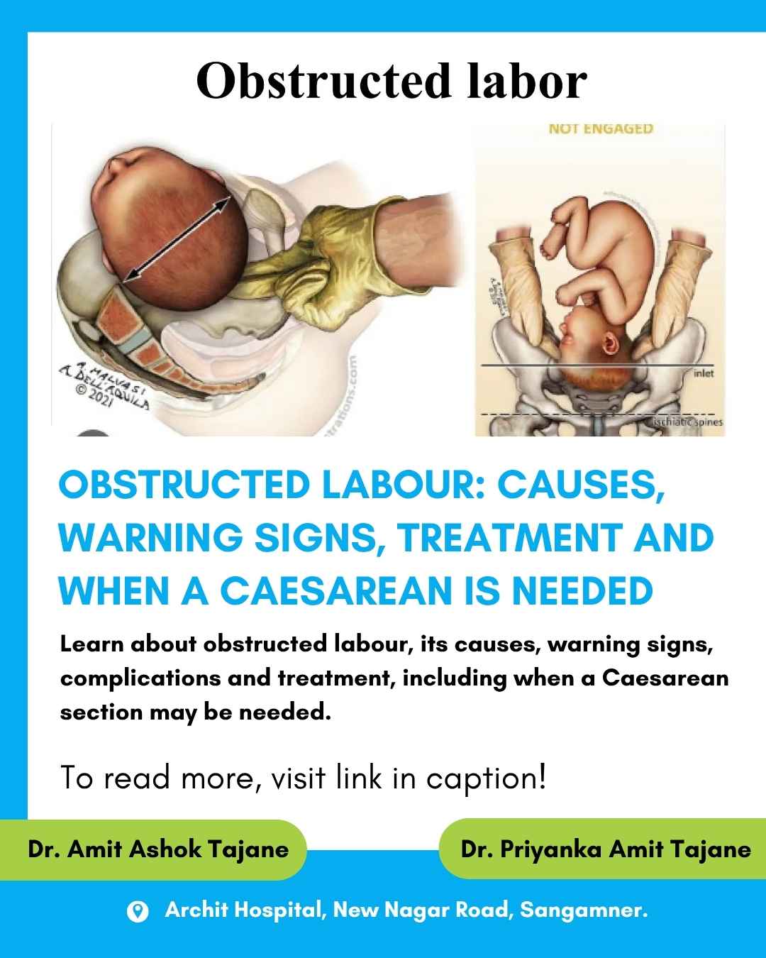 Obstructed Labour: Causes, Warning Signs, Treatment and When a Caesarean Is Needed